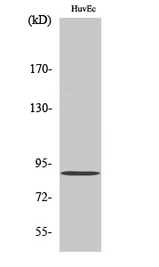iPLA2γ Polyclonal Antibody[410