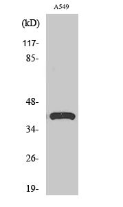 SP-B Polyclonal Antibody[41453