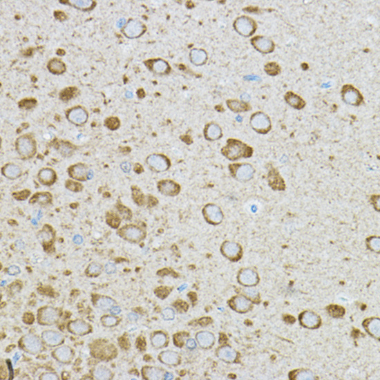 IRAK4 antibody[38750]
