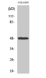 IL-13Rα1 Polyclonal Antibody[4
