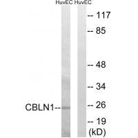 CBLN1 Antibody[34570]