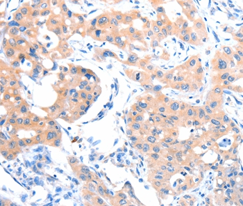 ACSM5 Antibody[36025]
