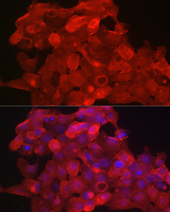 E-Cadherin Rabbit Polyclonal A
