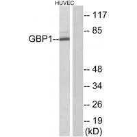 GBP1 Antibody[34250]