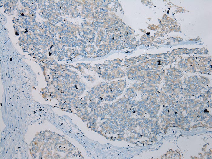 TLK2 Antibody[43337]