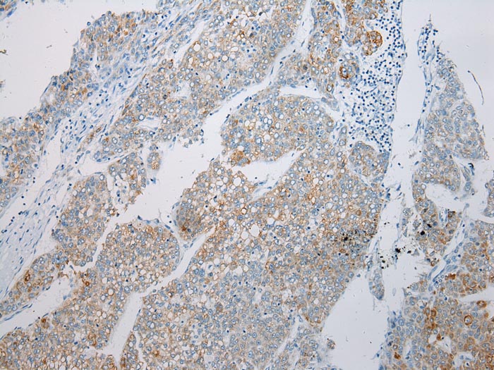 MGST1 Antibody[43149]