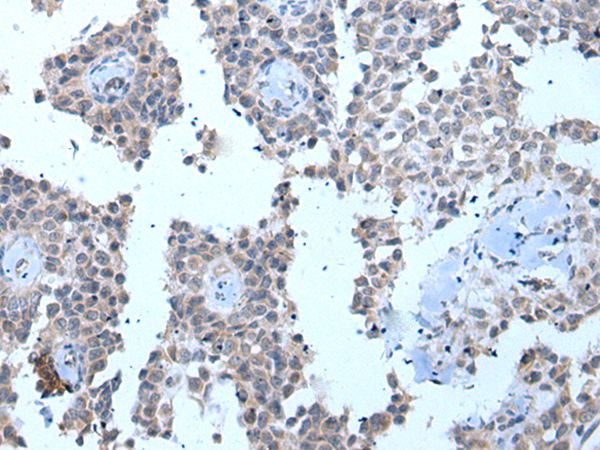 ZMYM2 Antibody[43970]