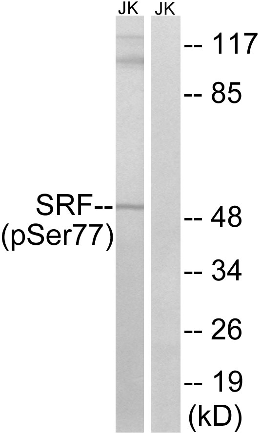 SRF (Phospho-Ser77) Antibody[1
