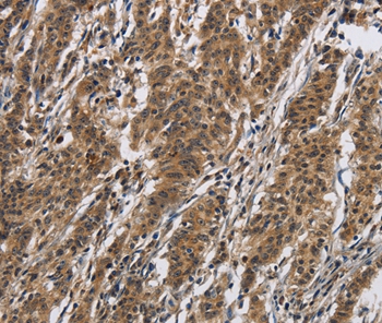 IL12RB2 Antibody[37645]