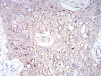 GLI1 Mouse mAb[63671]