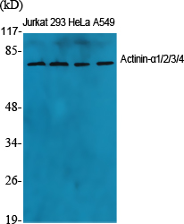 Actinin-α1/2/3/4 Polyclonal An
