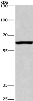 ARMCX2 Antibody[36262]