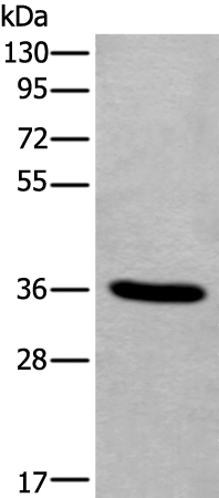 TNMD Antibody[43641]