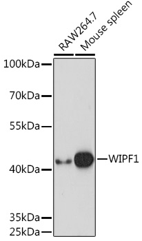WIPF1 Rabbit Polyclonal Antibo