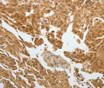 RETNLB Antibody[35905]