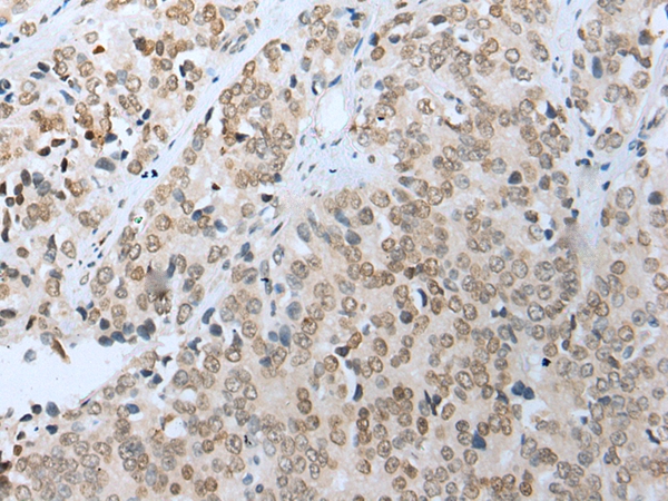 COMMD6 Antibody[42937]