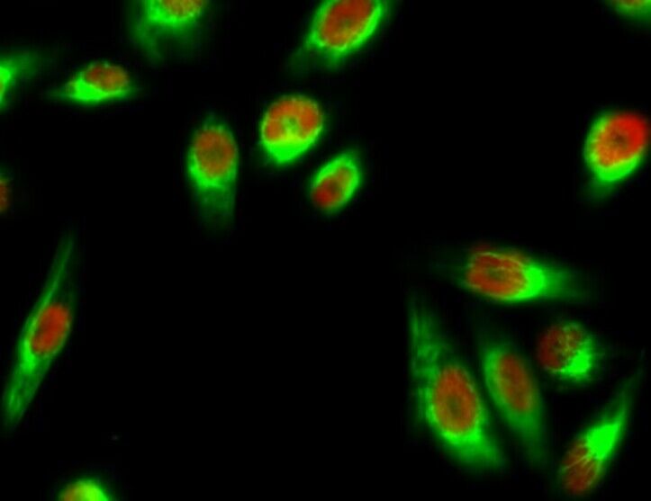 Stat1 Polyclonal Antibody[4146
