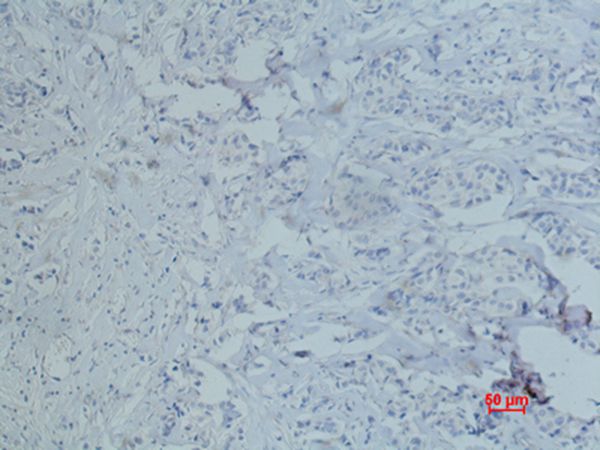 CD10 Monoclonal Antibody(5B8)[