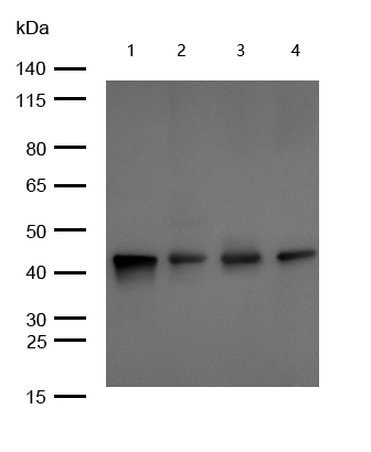 TRAM2 Rabbit mAb[56029]