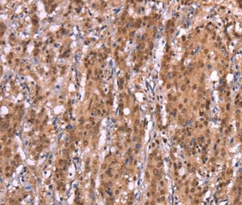 AMER1 Antibody[37563]