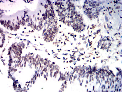 HNF4A Mouse mAb[63743]