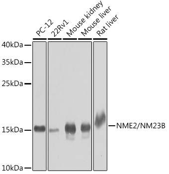 NME2 Rabbit Polyclonal Antibod