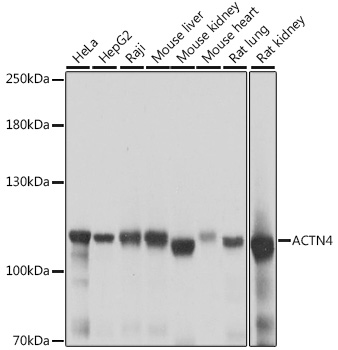 ACTN4 Rabbit Polyclonal Antibo