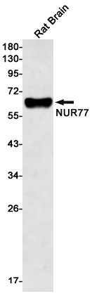 NUR77 Rabbit mAb[52478]