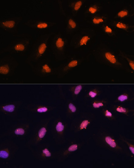 BAZ2A Rabbit Polyclonal Antibo