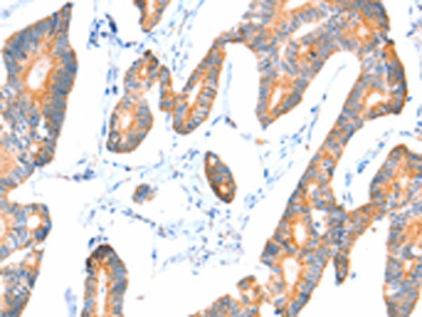 VANGL1 Antibody[35999]