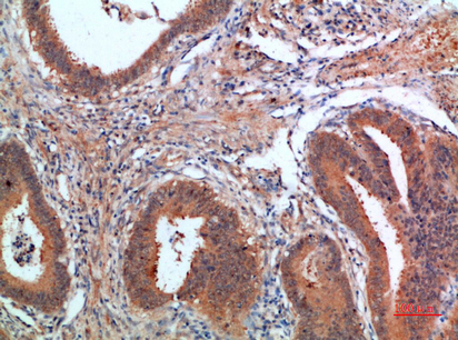 PDGF-C Polyclonal Antibody[468