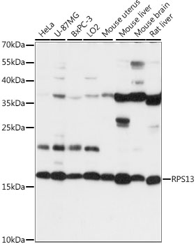 RPS13 Rabbit Polyclonal Antibo
