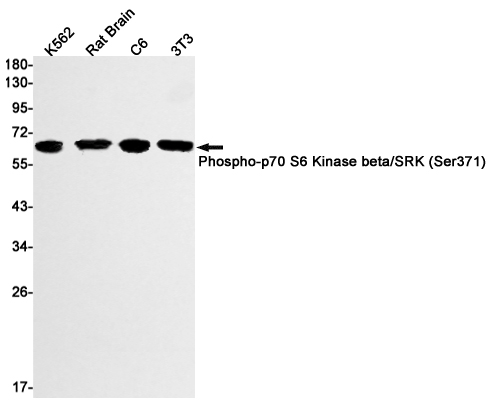 Phospho-S6K2 (Ser371) Rabbit m