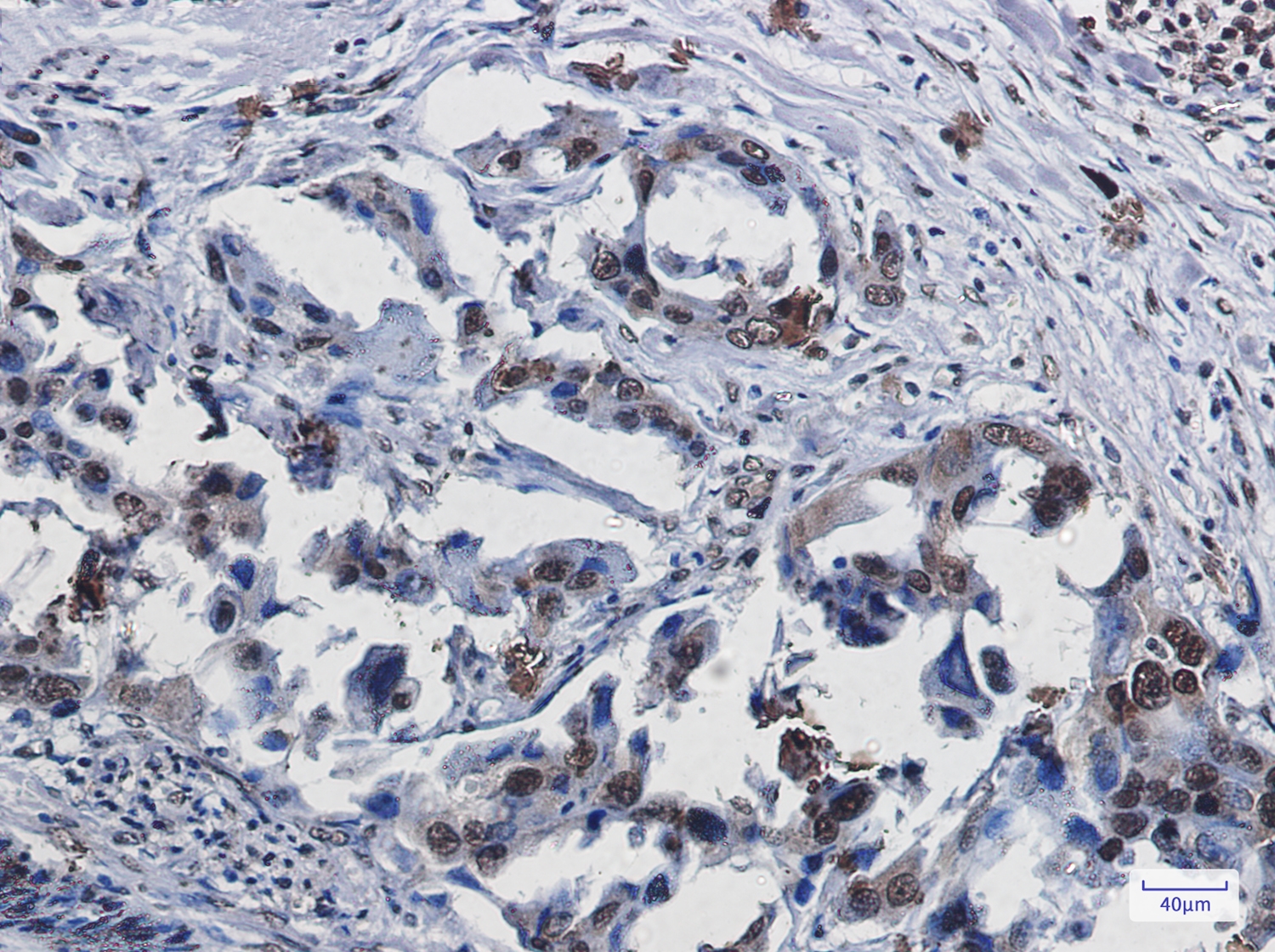 SUMO1 Rabbit mAb[52602]