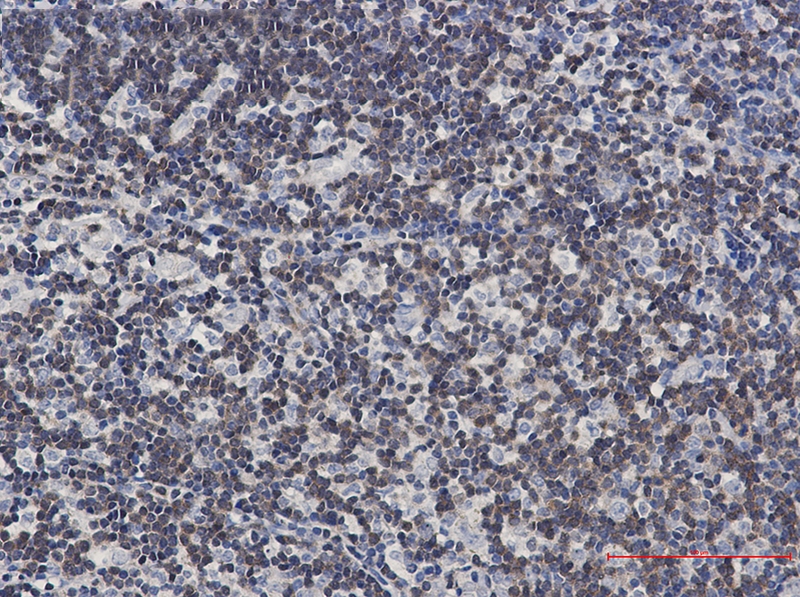 DGKA Rabbit mAb[52749]