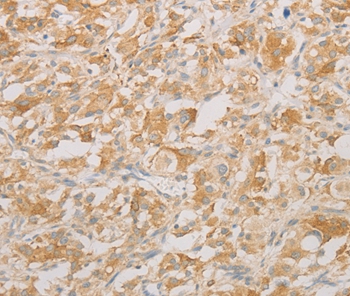AES Antibody[36095]