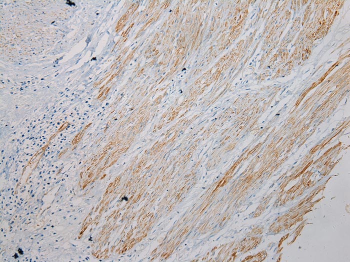 SESN3 Antibody[42754]