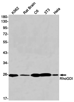 RhoGDI Rabbit mAb[52554]