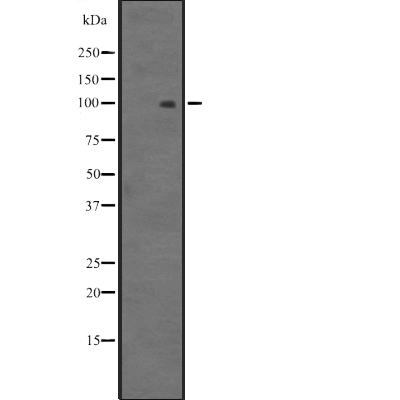 MYOCD Antibody[44757]