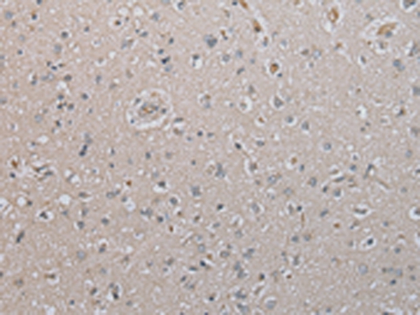 DAND5 Antibody[43367]