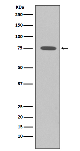 Somatostatin Receptor 2 Rabbit