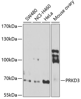 PRKD3 Rabbit Polyclonal Antibo
