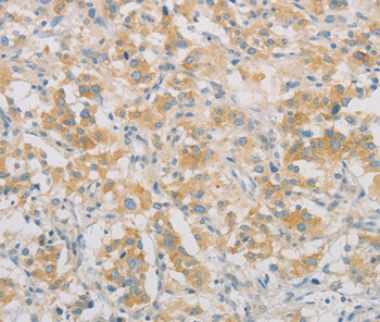 SPTLC1 Antibody[36175]
