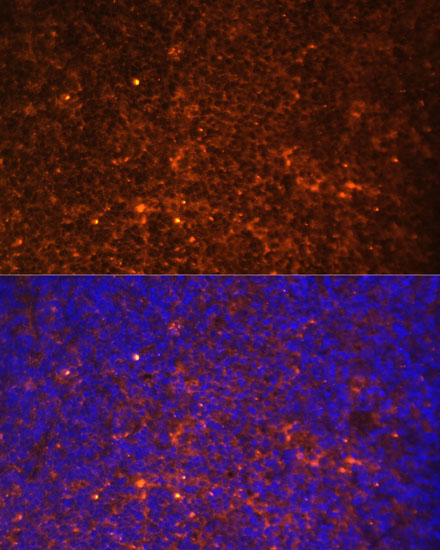 IL1 beta Rabbit Polyclonal Ant