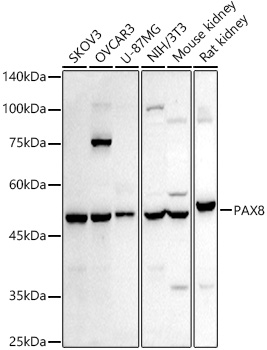 PAX8 Rabbit Polyclonal Antibod