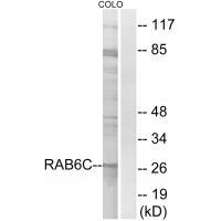 RAB6C Antibody[34973]