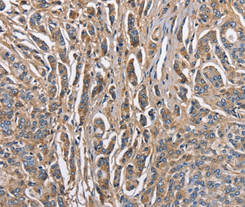 ABI3BP Antibody[36249]