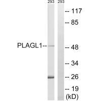 PLAGL1 Antibody[35206]