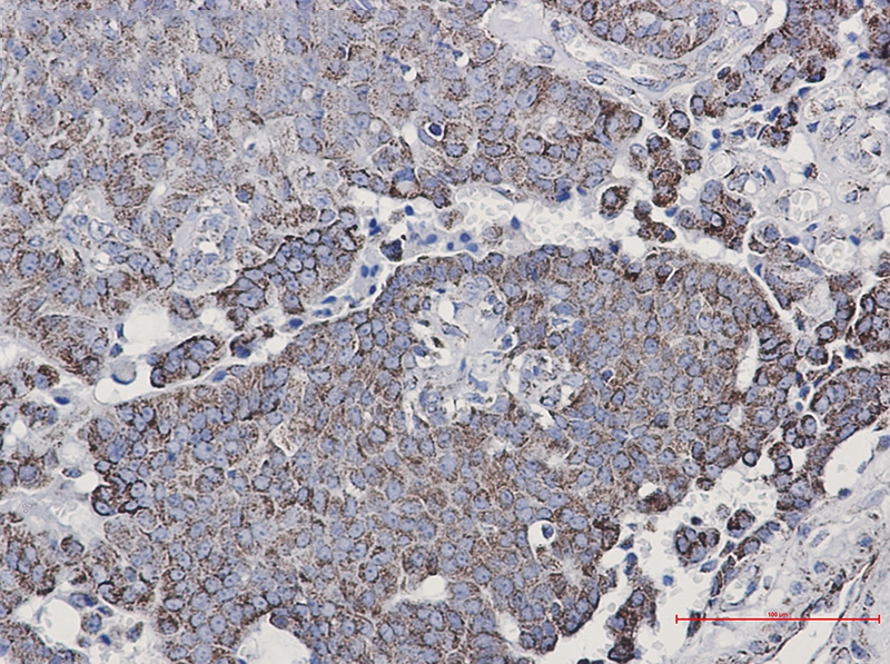 NDUFC2 Rabbit mAb[52451]