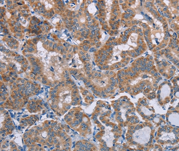 POMT1 Antibody[37839]